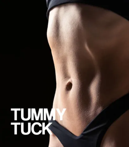 Tummy Tuck